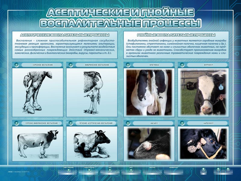 Интерактивный стенд "Асептические и гнойные воспалительные процессы"
